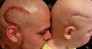 Su hijo le dijo que se sentía un «monstruo» y se tatuó la misma cicatriz de la operación de cáncer