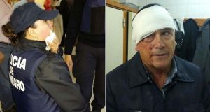 Manifestates de ATE atacaron a policias uno está con Fractura de maxilar y el otro tiene comprometida la órbita ocular