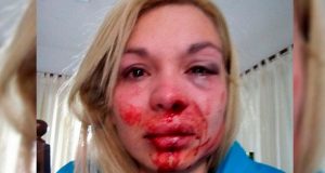 Una personal trainer sufrió una brutal golpiza de su pareja: «Me quiso tirar por las escaleras»