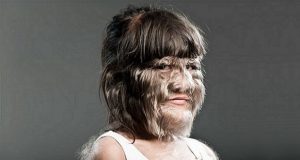 La mujer con el rostro más peludo del mundo se afeitó tras «encontrar el amor»