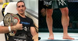 La estremecedora imagen de la pierna de un luchador de MMA que se volvió viral
