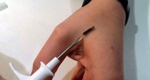 Implantarse chips es la moda