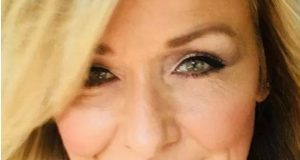 Así le quedaron los ojos a la mujer que no se sacó la máscara de pestañas durante 25 años