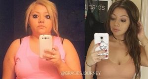La joven que bajó 50 kilos y ahora difunde su mensaje de «vida sana» por Instagram
