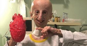La historia de Sammy Basso, el científica que se resiste a envejecer y busca una