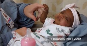 Nació la bebé más pequeña del mundo: pesa lo mismo que una manzana