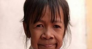 El extraño caso de la nena con “cara de abuela”