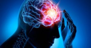 Día Mundial del Accidente Cerebrovascular: Ocho de cada 10 casos de ACV se puede prevenir