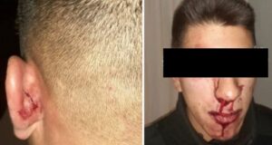 Cholila | Dos policías fueron atacados por un conductor enfurecido y sus acompañantes