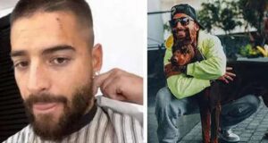 Maluma fue atacado por su perro y mostró las heridas en su rostro