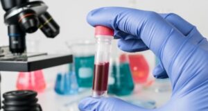 Hepatitis: Se estudian ocho casos sospechosos de origen desconocido en niños y niñas