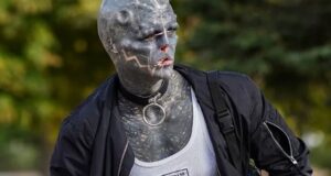 El hombre que quiere parecer un alien dice que ahora se amputará una pierna