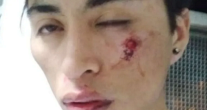 Comodoro | Denuncia por golpiza policial