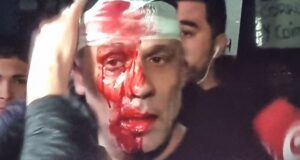 Un periodista de América TV fue brutalmente golpeado mientras cubría el acto de cierre de campaña de Milei