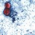 Reportan las primeras dos muertes por brote de ciclosporiasis en Estados Unidos